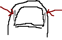 toenail1.gif